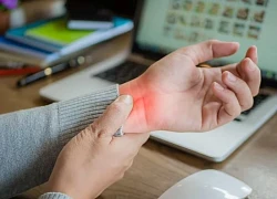 Tê tay do hội chứng ống cổ tay cần phát hiện sớm