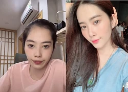 Nam Em bất ngờ tái xuất "phốt" tình cũ, tiết lộ bệnh lạ, CĐM hoang mang