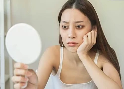 Nguyên nhân khiến mắt thâm quầng mà ít người biết