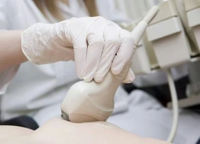 Các loại u vú thường gặp, cách nhận biết sớm nhất