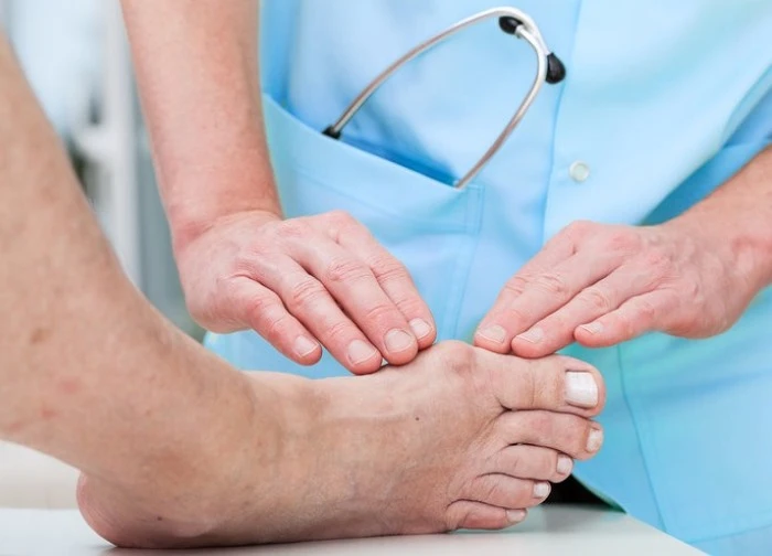 Liều lĩnh đánh cược mạng sống với mẹo 'chích máu trị gout'