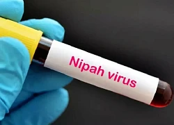 Ấn Độ: Bang Kerala ghi nhận 2 ca nhiễm virus Nipah mới