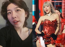 Em Xinh xinh như Suzy bị khui ảnh quá khứ, visual lạ cỡ này bảo sao không bị nói "sửa hết mặt"