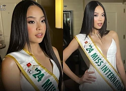 Hoa hậu Thanh Thuỷ mặt sưng phồng gây sốc, chuyện gì thế này?