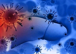 Thêm liệu pháp điều trị virus viêm gan C cấp tính