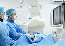 Đau đầu, khó nói, người phụ nữ bị nhồi máu não do căn bệnh hiếm gặp