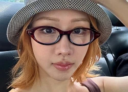 Gương mặt ngày càng đơ cứng của MIN