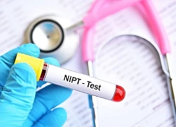 Xét nghiệm sàng lọc trước sinh nhằm phát hiện bệnh di truyền nghiêm trọng