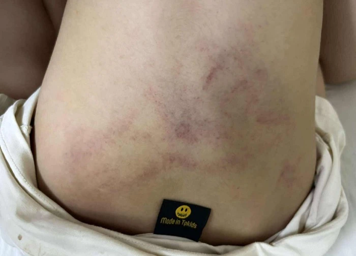 Bé gái bị đánh, kéo lê ở trường mầm non Hà Nội: Tạm đình chỉ giáo viên chứng kiến nhưng mặc kệ
