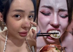 DJ Ngân 98 thản nhiên ăn hải sản khi mũi đang bị biến chứng nhiễm trùng nặng?