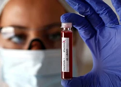 25 bang Mỹ ghi nhận ca Covid-19 tăng, xuất hiện virus khác diễn biến bất thường