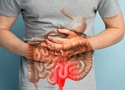 Người đàn ông nguy kịch vì xuất huyết "vùng bóng tối" trong hệ tiêu hóa