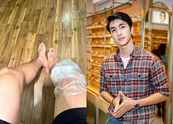 Tình trạng nghiêm trọng của nam thần VFC sau 1 năm bị đứt dây chằng chéo trước