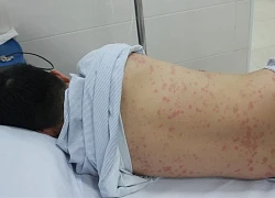Cảnh báo tai biến nghiêm trọng khi massage cổ vai gáy sai cách