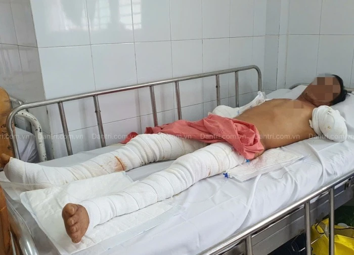 Người đàn ông bị điện phóng cụt 2 tay nghẹn ngào: "Mọi người đừng như tôi"