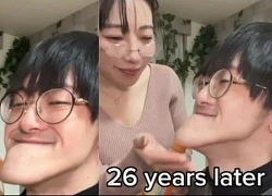 Người đàn ông khiến bác sĩ sốc nặng khi có 'chiếc cằm dài nhất thế giới'