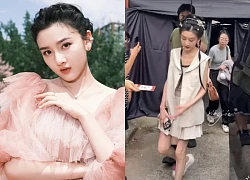 "Mỹ nữ đẹp nhất 2025" bất ngờ xuống sắc kinh hoàng như "bộ xương di động", gây sốc MXH