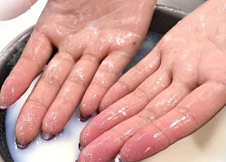 Cô gái 20 tuổi phải đi cấp cứu vì tai nạn bất ngờ khi làm món chân gà sả ớt