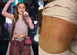 Phương Mỹ Chi gặp nguy, bác sĩ cũng đành bó tay