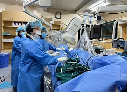 Điều trị rung nhĩ bằng kỹ thuật mới bóng áp lạnh