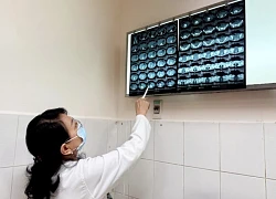 Điều trị thành công viêm tụy cấp hiếm gặp ở bé gái 8 tuổi