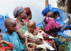 Gambia tuyên bố bùng phát dịch bệnh đậu mùa khỉ