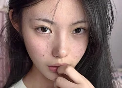 Làn da li ti mụn đã được cải thiện hoàn toàn nhờ 5 chiêu đơn giản