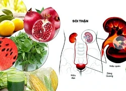 Biện pháp đơn giản hàng đầu giúp đẩy lùi sỏi thận