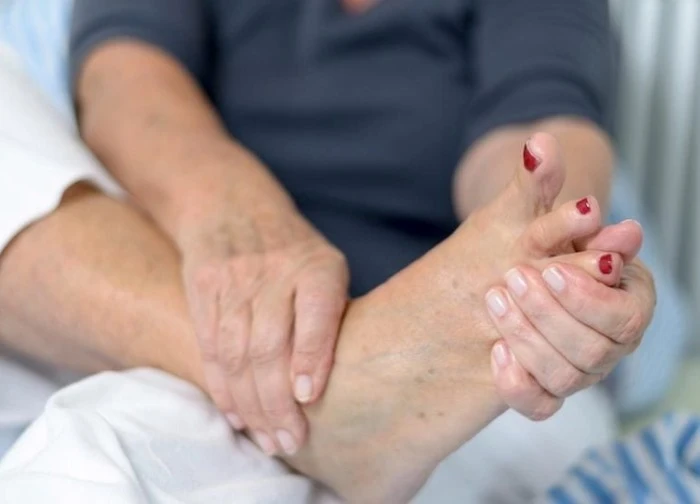 Biểu hiện biến chứng thận ở bệnh nhân tiểu đường