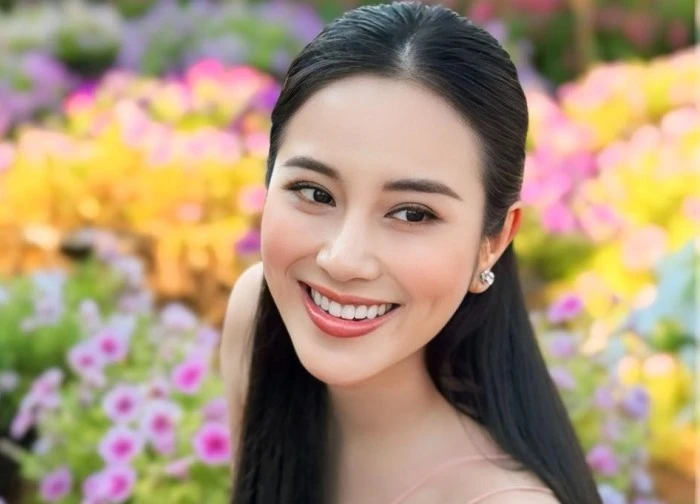 Ca sĩ Tố My nhập viện vì phình động mạch não, sức khỏe hiện ra sao?