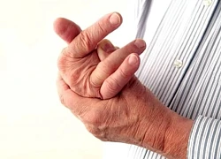 Bệnh lý xương khớp dễ nhầm lẫn, khó phát hiện