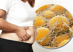 Làm thế nào để loại bỏ mỡ nội tạng nhanh chóng?