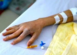 Phát hiện ung thư muộn vì chủ quan với dấu hiệu lạ khi tiểu