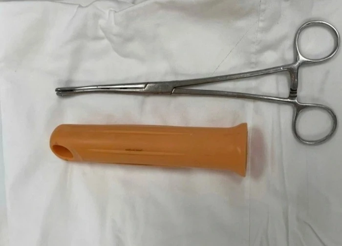 Nam thanh niên bị mắc kẹt cán cây lau nhà 15cm trong hậu môn
