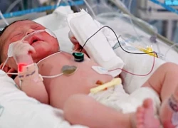 Báo động sốc nhiễm khuẩn ở trẻ