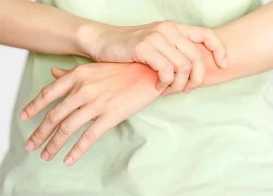 Căn bệnh ít được biết đến đang đe dọa hàng tỷ người, triệu chứng và cách phòng tránh