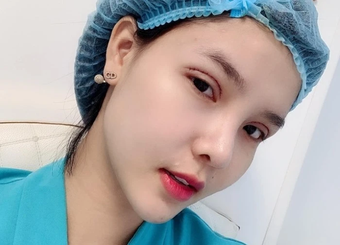 Người mẫu Việt tự khui ảnh thẩm mỹ mặt, thừa nhận rơi khủng hoảng vì sợ biến dạng vĩnh viễn