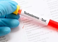 Nguyên nhân nam giới trẻ bị testosterone thấp