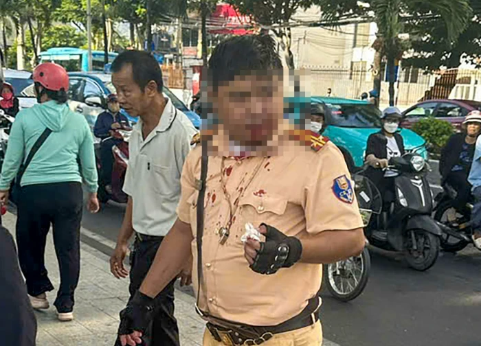 Hé lộ động cơ phi lý của người đàn ông nước ngoài "tác động vật lý" vào cảnh sát giao thông giữa phố