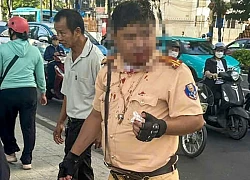 Trung tá CSGT ở Nha Trang bị người nước ngoài đấm vào mặt khi đang làm nhiệm vụ