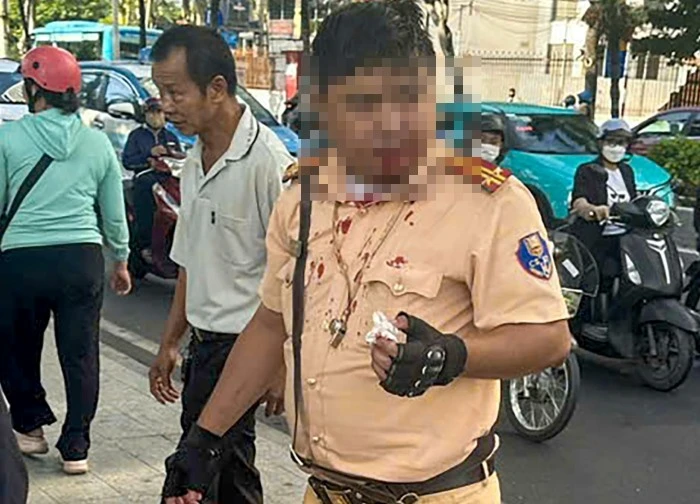 Trung tá CSGT ở Nha Trang bị người nước ngoài đấm vào mặt khi đang làm nhiệm vụ