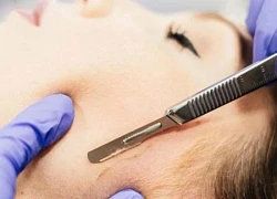 Bác sĩ chỉ cách cạo lông mặt không bị mụn, da mịn như em bé