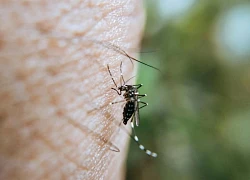 Chikungunya có đặc điểm giống bệnh sốt xuất huyết, làm sao để phân biệt?
