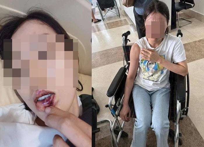 Xác minh clip chủ quán cà phê xông vào tận nhà hành hung cô gái ở TPHCM