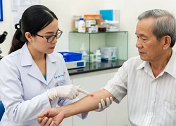 Người cao tuổi và những bệnh da thường gặp