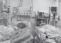 Hai cháu bé bỏng thương tâm, nghi bị cha ruột tưới xăng châm lửa đốt