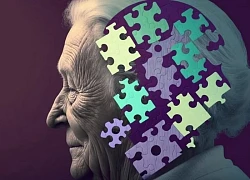 Nguyên tố Lithium mở hy vọng mới cho điều trị bệnh Alzheimer
