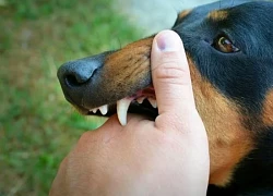 Bị chó nhà cắn, hai người ở TP.HCM không qua khỏi