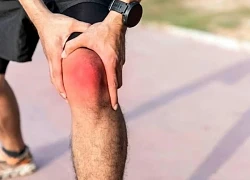 Đau nhức sau khi tập luyện thể thao, có nên dán miếng giảm đau?