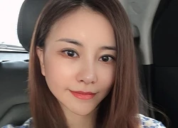 Diễn viên Kim Oanh lên tiếng sau khi gây tranh cãi vì phẫu thuật thẩm mỹ cả gương mặt